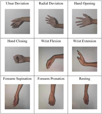 Robust gesture recognition based on attention-deep fast convolutional neural network and surface electromyographic signals